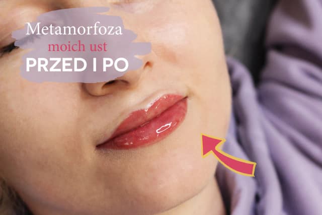 Jak wyglądają usta po makijażu permanentnym? Efekty i zmiany po zabiegu
